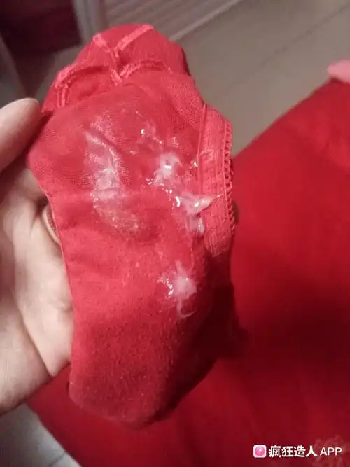 早上起来发现内裤上好多酸奶状白带,是排卵