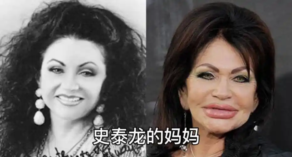 知名女星整容失败!看众多女星失败案例_腾讯新闻