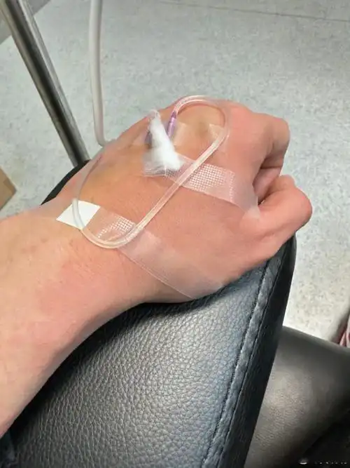 看到他手背处扎着针,并且也红肿,真的有些心疼啊.