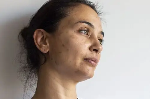 我们皮肤为什么会发黄主要由什么原因导致的