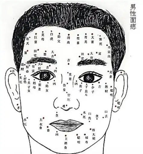 痣寓意好吗,q1算命面相中水厄是什么意思水厄就是犯水险即在水里会有