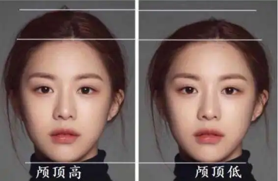 张立彬科普什么是高颅顶