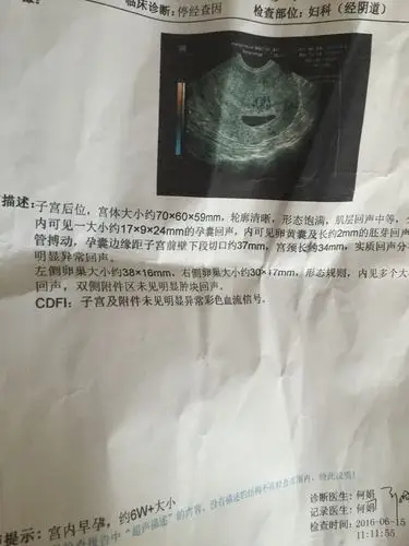 姐妹们 孕囊隔两天就由茄子变成椭圆了.孕囊看男女好像不靠谱呀!