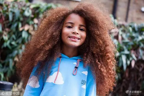 英国6岁男孩因天生爆炸头走红发量惊人实力打击脱发一族