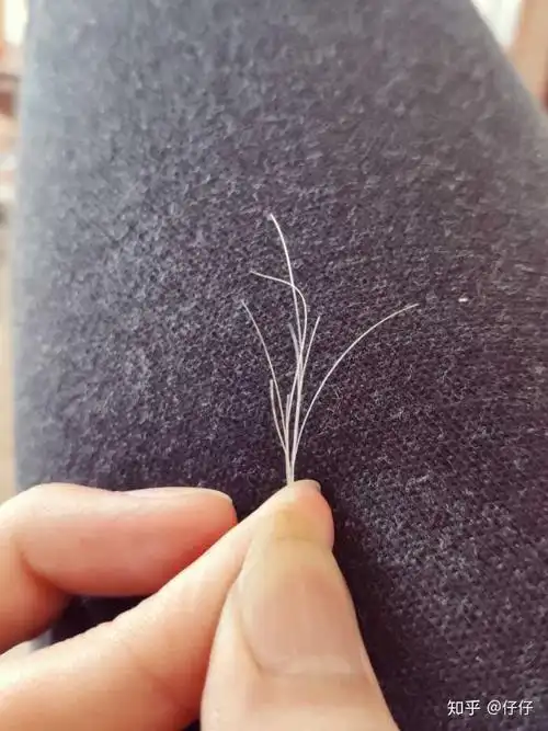 今年两鬓长出的8根白发