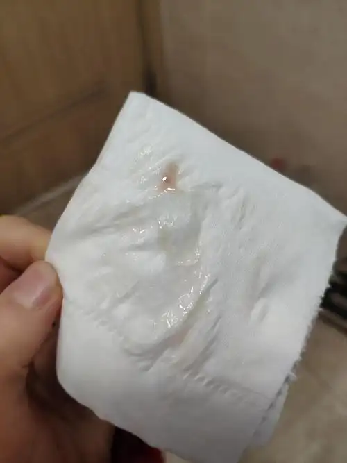 白带带血什么情况