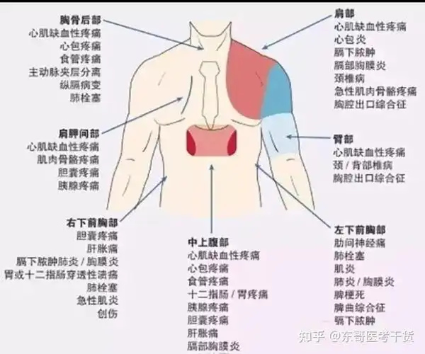 常见的腹痛及相关鉴别诊断 - 知乎