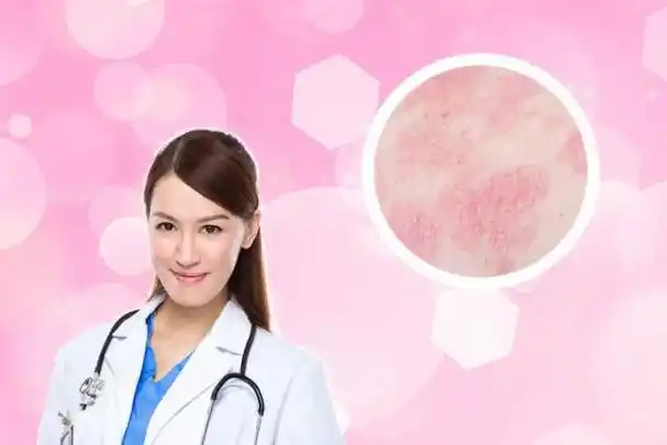 癣可以自己治愈吗