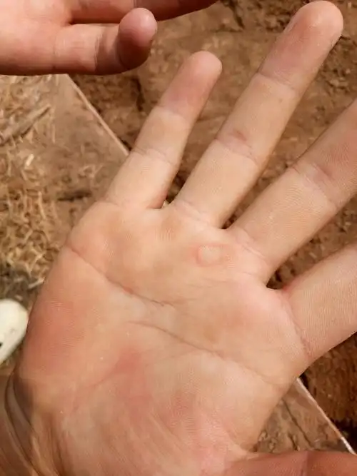 工作的第一天,科技的手上已经磨出了水泡!