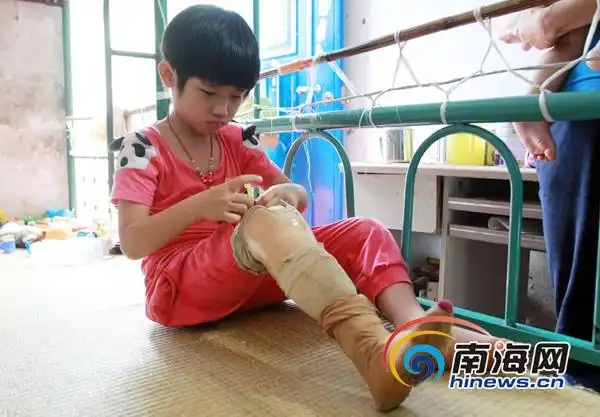 万宁6岁女童遭车辆碾压截肢换假肢费用大家庭难承受