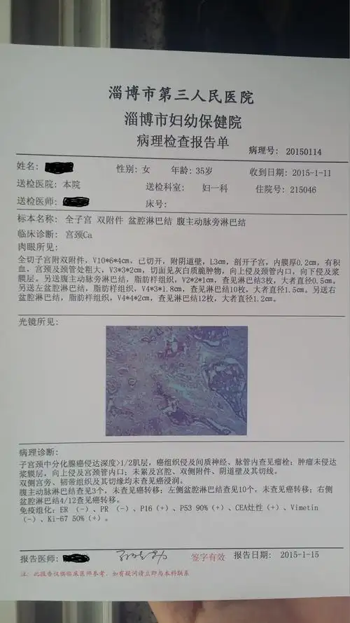 请教各位高手宫颈腺癌