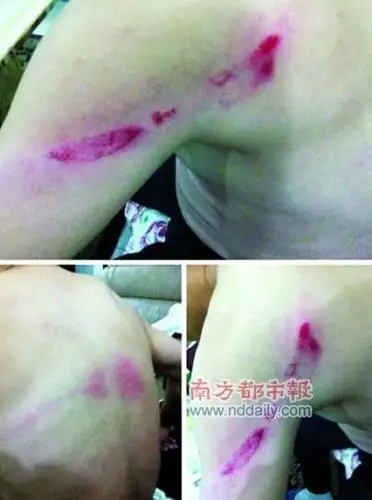 东莞运政执法领导误坐黑的遭围殴皮开肉绽(图)