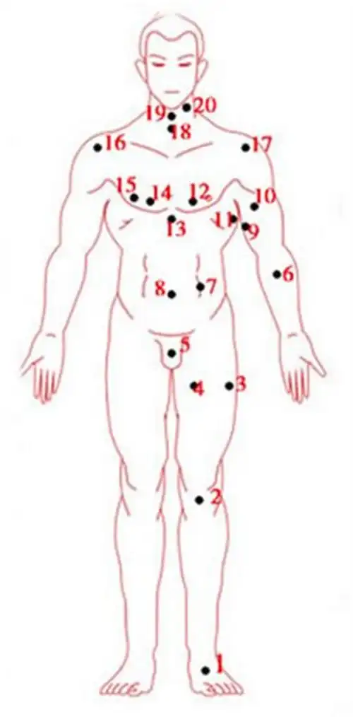 女人面部痣相图解_有来医生