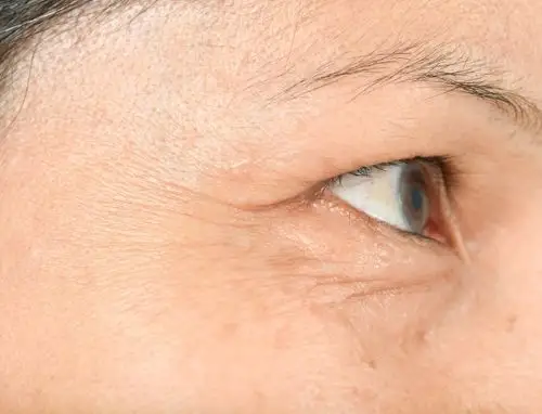 鱼尾纹图片_高清鱼尾纹图片大全_正版鱼尾纹图片素材下载-veer图库