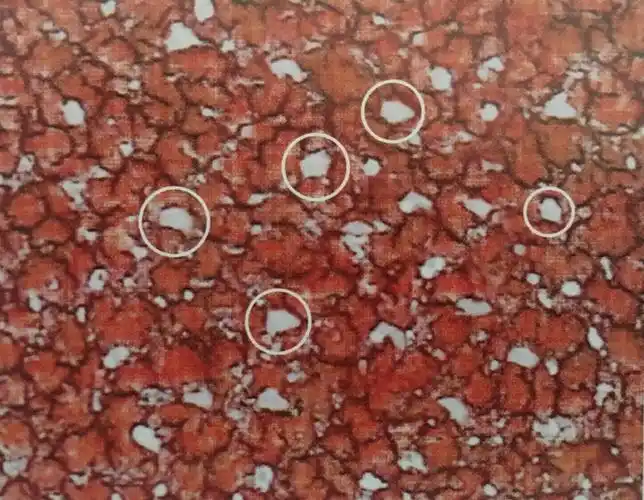 一滴血检测自由基分析