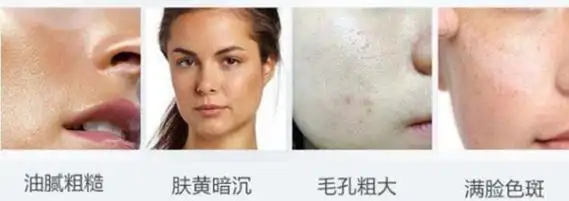 医美问答做超皮秒祛斑对皮肤有伤害吗超皮秒祛斑的副作用是啥