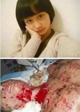 "少女毁容案"不是一个"官二代"的问题