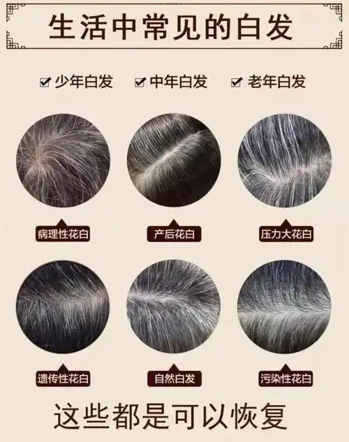 [白发变黑发]去白发变黑发何首乌白转黑洗发水防脱控油去油去屑 1瓶