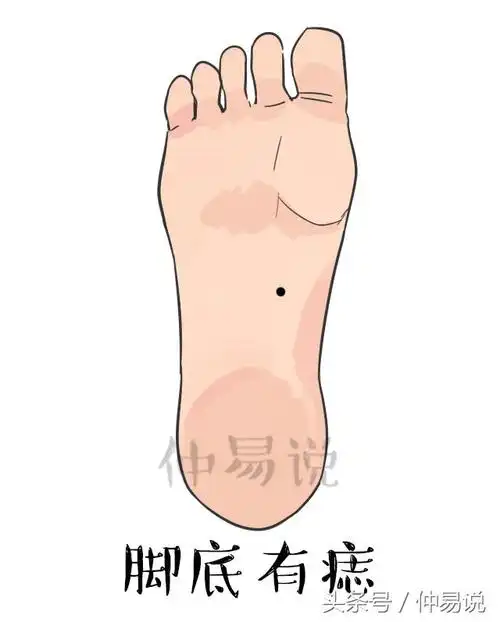 身体上最有福气的痣,你有哪几颗?