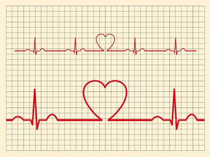 医疗心电图心形图片