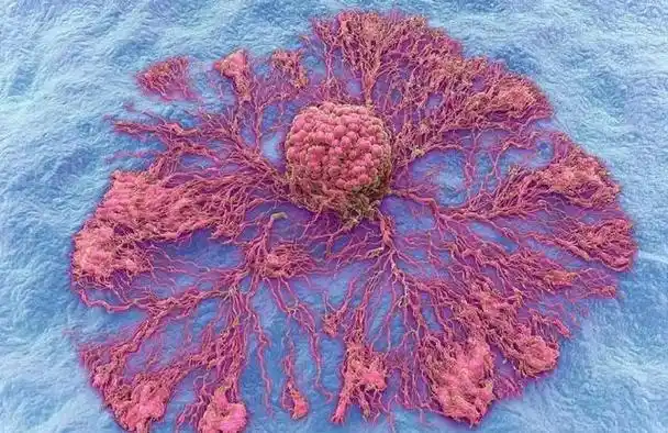 癌症细胞的无限增殖一直是科学家们困惑的问题.