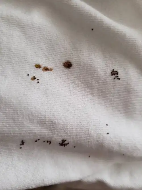 跳蚤卵不应该有这么大啊大家有没有相同的情况帮我看看这个是什么卵