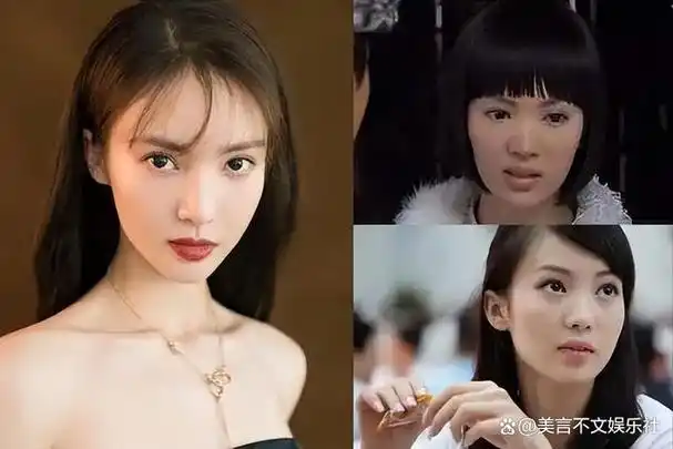 爱上整容,后遗症凸显,金晨终于明白自己被医美坑惨了!