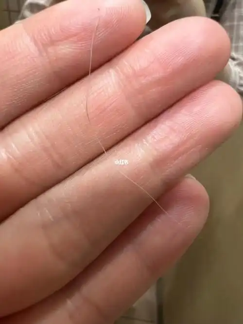 一根正在努力变黑的白发