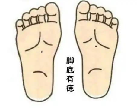 脚底有痣寓意权势,地位和福气,相学中确实也有不少王侯将相有这类痣