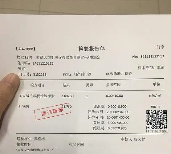 装逼神器之怀孕检验报告单