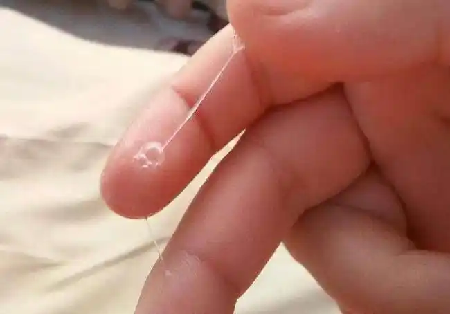 如果突然发现自己内裤上出现分泌物增多的情况,那么很可能就是因为