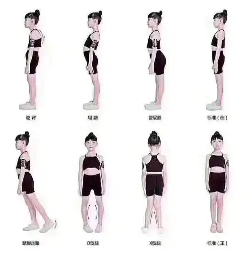 对比一下孩子的体态问题