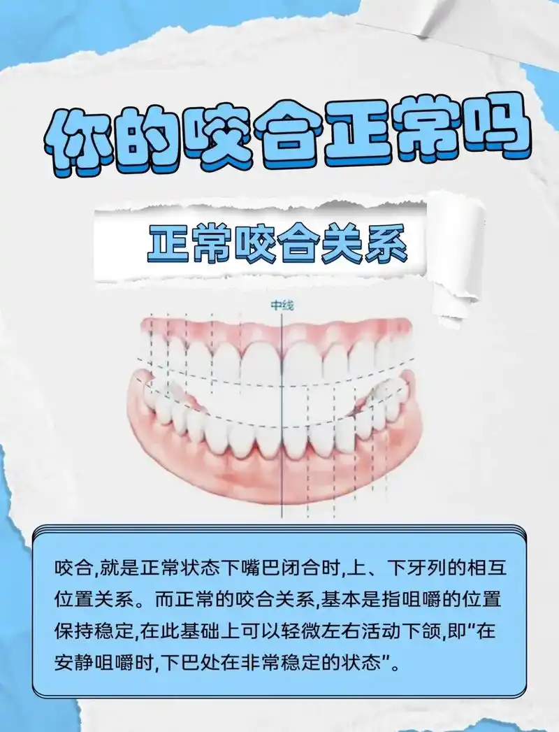 你真的知道什么是正常咬合吗?