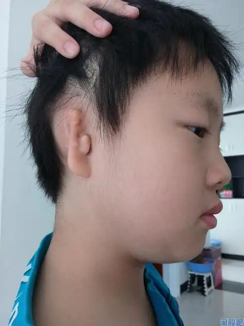 求助万能淘股吧耳朵畸形整形的名医或做整形的权威医院