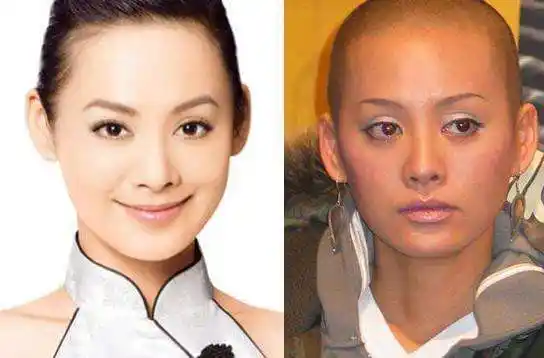 宁静当年为什么要剃光头宁静剃光头的真实原因竟是