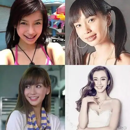 这几位女明星,整容痕迹突出,奈何嘴犟不承认