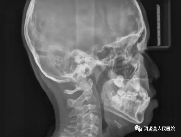 可拍全景片,头颅侧位片,牙颌面锥形束ct ,全方位