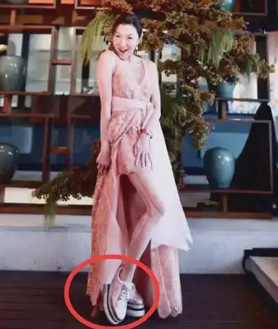 杨紫琼那变形了的脚,挺严重的!