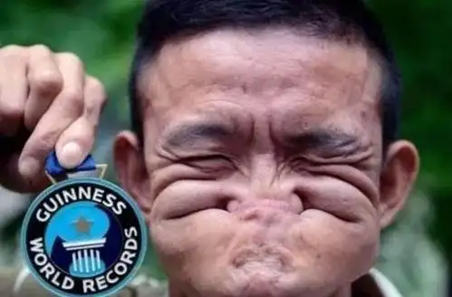 男子获吉尼斯认证最"丑"纪录,并向世界发起挑战