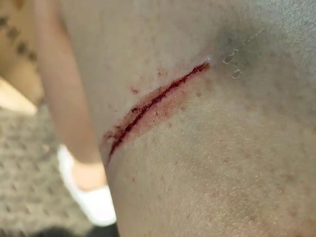 人家想不开割手腕,你咋割 - 抖音