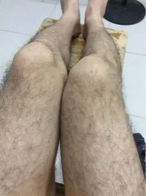 腿毛浓密用激光来脱毛有效吗