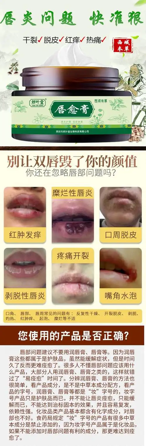 口唇炎唇膏嘴唇干裂口角红痒起皮脱皮慢性唇炎润唇膏修复嘴唇粘膜防