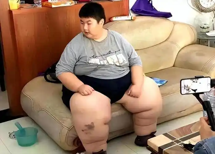 回顾江西14岁男孩体重300斤6秒吞下一碗米粉临终愿望令人唏嘘