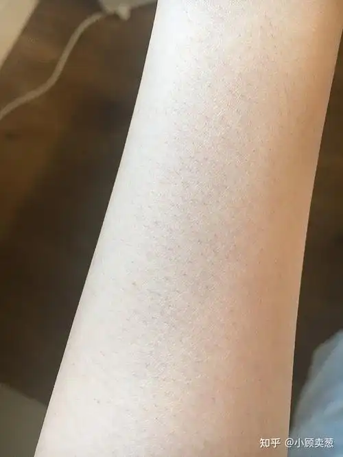 谁知道怎么才能脱毛