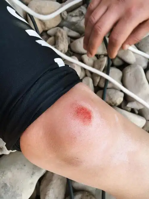 美腿女警黎真安 高空威压降落腿受伤