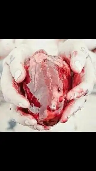 求个 流血的心的头像