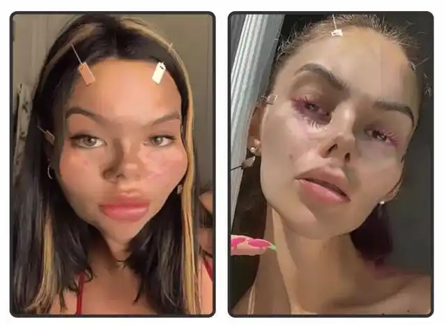 张雨绮的鼻子歪了整容式滤镜也太可怕了吧