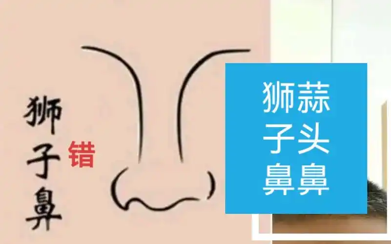 狮子鼻和蒜头鼻的区别仅供娱乐
