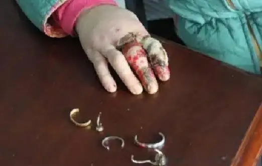 戴戒指打保龄球的恐怖图片血腥事件的后果有多恐怖