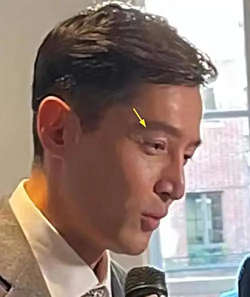 41岁胡歌伦敦开会!颜值回春变帅气,生图白发抢镜,疤痕加深